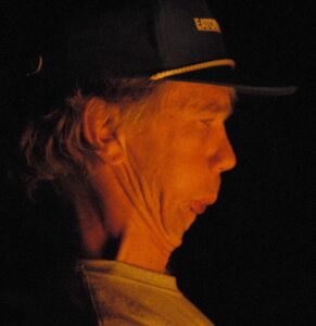 Noel Rhodes Noel makes his chin go away